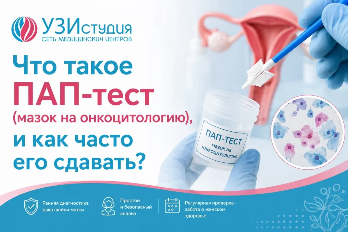 Что такое ПАП-тест (мазок на онкоцитологию), и как часто его сдавать?