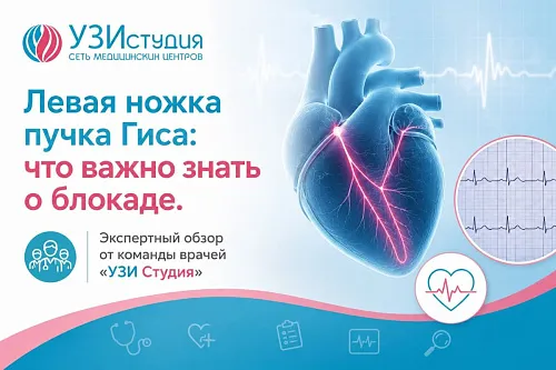 Левая ножка пучка Гиса: что важно знать о блокаде. Экспертный обзор от команды врачей «УЗИ Студия»