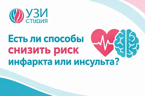 Есть ли способы снизить риск инфаркта или инсульта?
