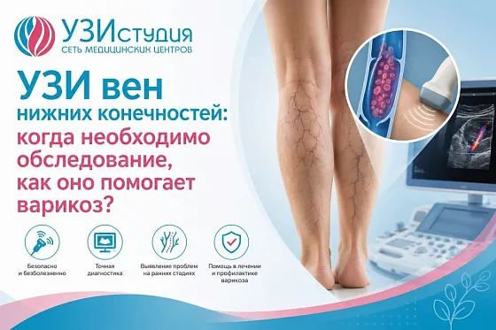 УЗИ вен нижних конечностей: когда нужно обследование, как оно помогает выявить варикоз и его виды?