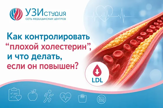 Шпаргалка: как контролировать "плохой холестерин", и что делать, если он повышен?