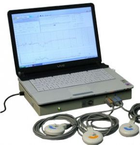 Кардиотокограф - интранатальный фетальный монитор с автоматическим анализом КТГ «Уникос» 